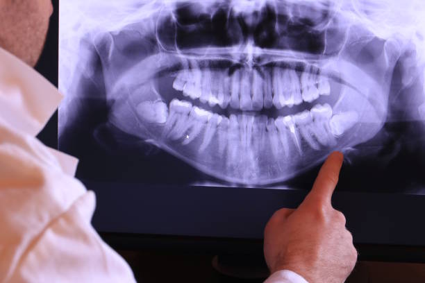 Best Same-Day Emergency Dentist in Toftrees, PA